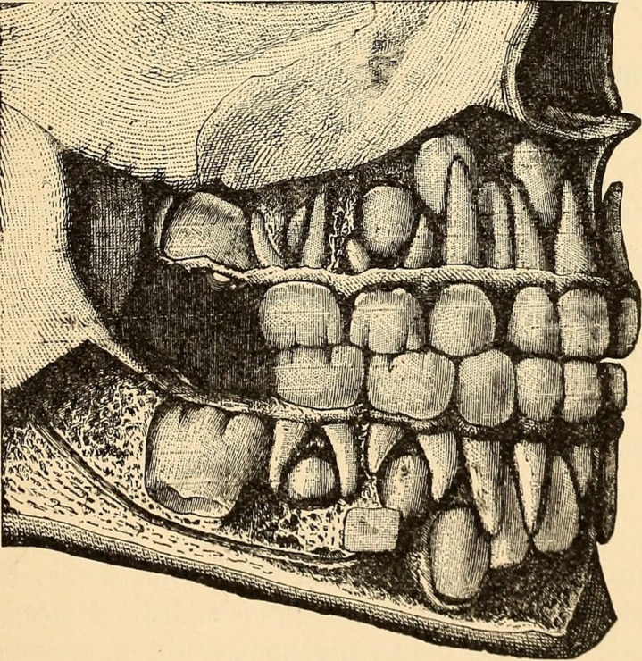 anatomical view of a mouth and teeth